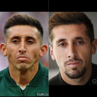 Hector Herrera rhinoplastie otoplastie