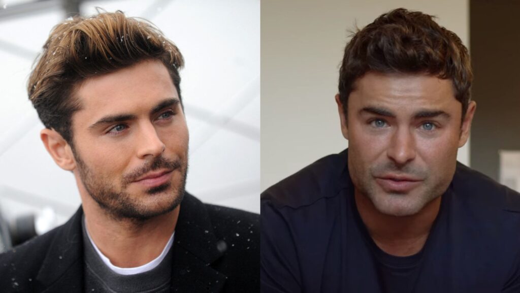 chirurgie esthétique zac efron