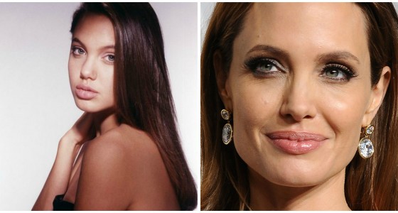 Angelina Jolie et la chirurgie esthétique