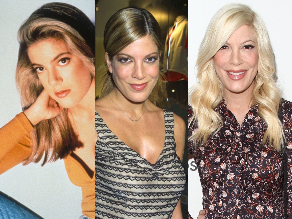 Tori-Spelling chirurgie visage