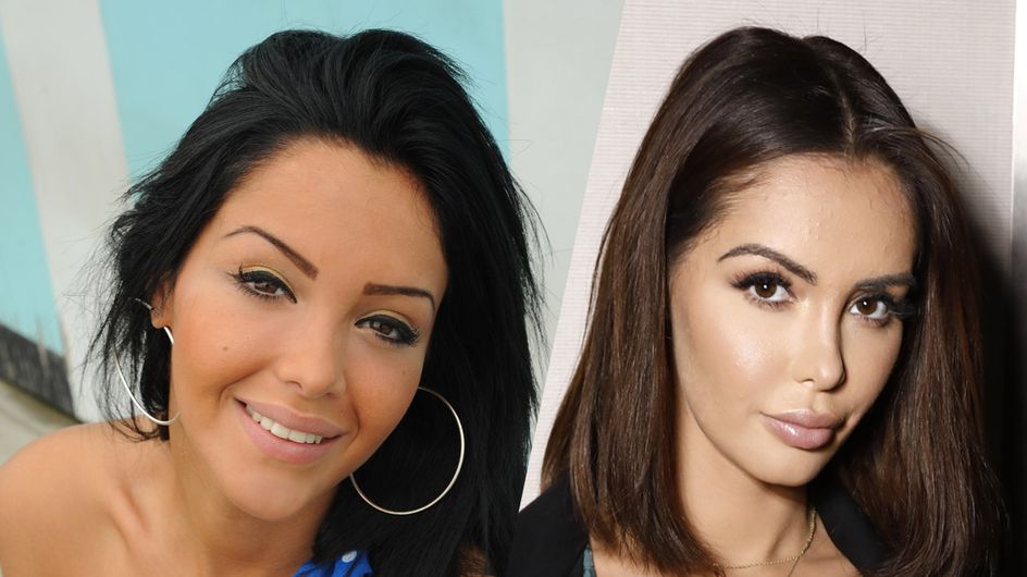 nabilla et chirurgie esthétique