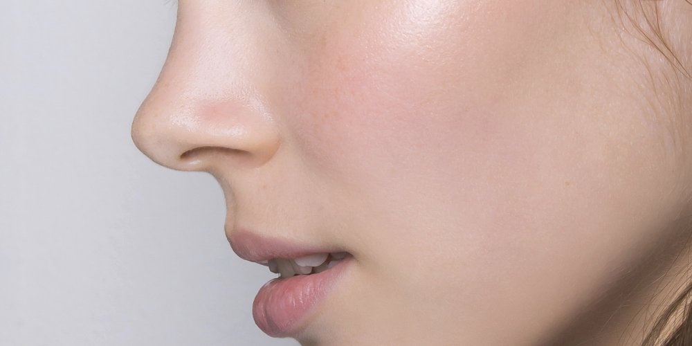 Rhinoplastie classique Ou Rhinoplastie Ultrasonique